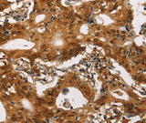 Anti-Human Cav1.2 Antibody - ABMIUM