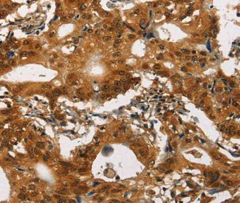 Anti-Human Cav1.2 Antibody