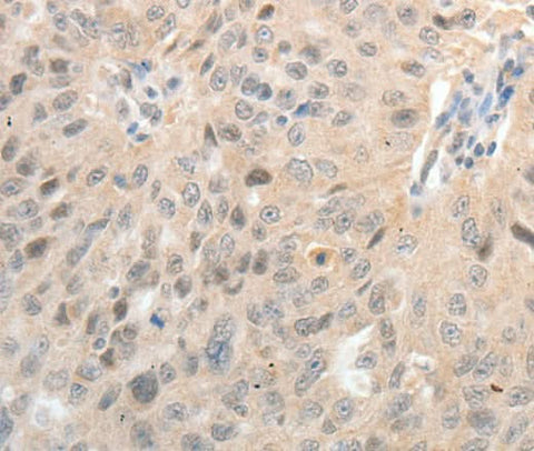 Anti-Human/Mouse/Rat ASCL1 Antibody - ABMIUM