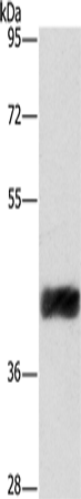 Anti-Human CRELD2 Antibody - ABMIUM