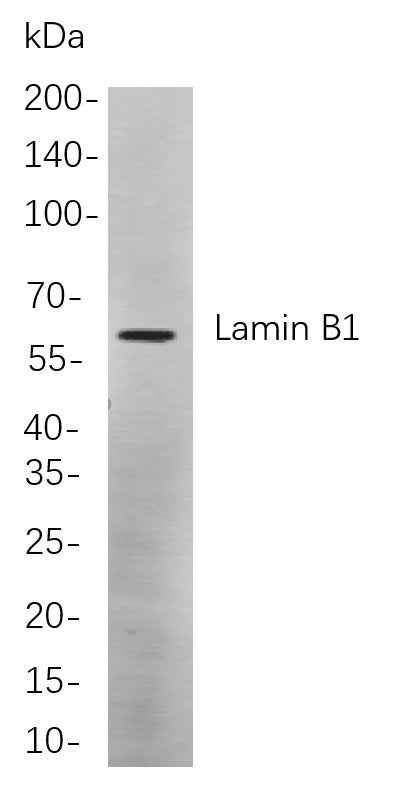 Anti-Human/Mouse/Rat Lamin B1 Antibody [B790] - ABMIUM