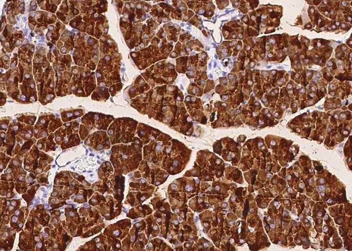 Anti-Mouse CEL Antibody [B466]