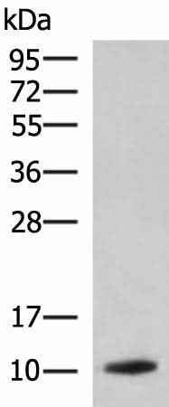 Anti-Human/Rat PPY Antibody