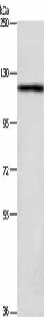 Anti-Human TSPYL2 Antibody - ABMIUM