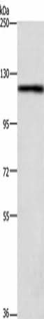 Anti-Human TSPYL2 Antibody - ABMIUM