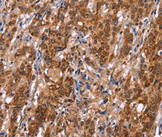 Anti-Human TDP2 Antibody