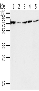 Anti-Human/Mouse/Rat NDUFS1 Antibody - ABMIUM
