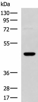 Western blot analysis of TM4 cell lysate using DNAJA4 Polyclonal Antibody at dilution of 1:800