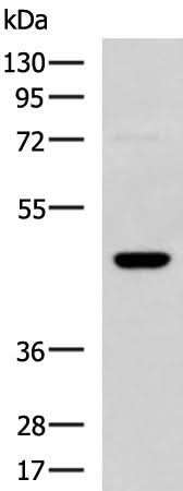 Western blot analysis of TM4 cell lysate using DNAJA4 Polyclonal Antibody at dilution of 1:800