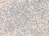 Immunohistochemistry of paraffin-embedded Human tonsil tissue using ADAMTS2 Polyclonal Antibody at dilution of 1:45(×200)