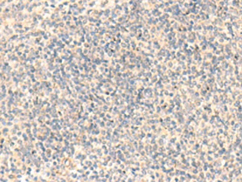 Immunohistochemistry of paraffin-embedded Human tonsil tissue using ADAMTS2 Polyclonal Antibody at dilution of 1:45(×200)
