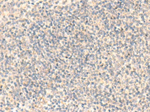 Immunohistochemistry of paraffin-embedded Human tonsil tissue using ADAMTS2 Polyclonal Antibody at dilution of 1:45(×200)