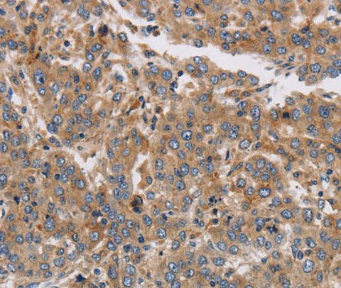 Anti-Human/Mouse/Rat KCNG1 Antibody - ABMIUM