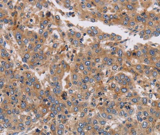 Anti-Human/Mouse/Rat KCNG1 Antibody - ABMIUM