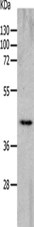 Anti-Human/Mouse/Rat CHRNA7 Antibody - ABMIUM