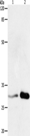 Anti-Human/Mouse/Rat YWHAB Antibody - ABMIUM