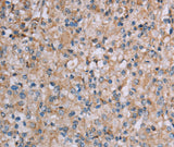 Anti-Human/Mouse PLXNA4 Antibody - ABMIUM