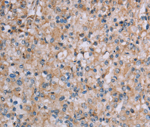 Anti-Human/Mouse PLXNA4 Antibody - ABMIUM