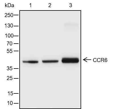Anti-Human CCR6 Antibody [A154] - ABMIUM