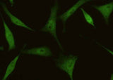 Anti-Human EIF4EBP1 Antibody [A936] - ABMIUM