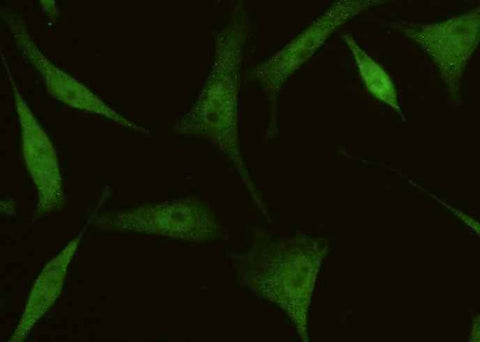 Anti-Human EIF4EBP1 Antibody [A936] - ABMIUM