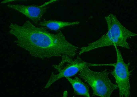 Anti-Human B2M Antibody [A1129] - ABMIUM
