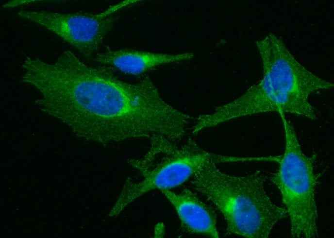 Anti-Human B2M Antibody [A1129] - ABMIUM