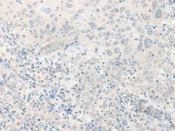 Anti-Human/Mouse/Rat TIMM8A Antibody