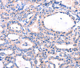 Anti-Human/Mouse/Rat DUSP12 Antibody - ABMIUM