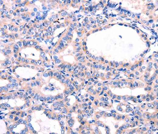 Anti-Human/Mouse/Rat DUSP12 Antibody