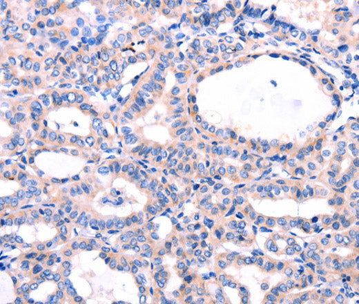 Anti-Human/Mouse/Rat DUSP12 Antibody - ABMIUM