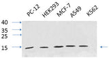 Western Blot analysis of various cells using IL8 Polyclonal Antibody at dilution of 1:1000.