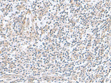 Immunohistochemistry of paraffin-embedded Human tonsil tissue using TNNC2 Polyclonal Antibody at dilution of 1:50(×200)