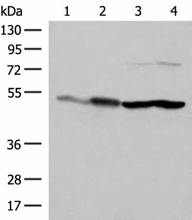 Western blot analysis of Mouse brain tissue HepG2 A375 Hela cell lysates using FLOT2 Polyclonal Antibody at dilution of 1:350