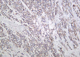 Anti-Human/Mouse/Rat Actinin-α1 Antibody [B1055]