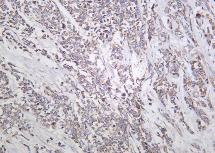 Anti-Human/Mouse/Rat Actinin-α1 Antibody [B1055]