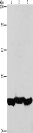 Anti-Human/Mouse/Rat PGK1 Antibody - ABMIUM