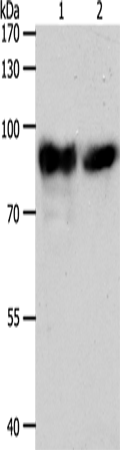 Anti-Human/Mouse/Rat ACO2 Antibody - ABMIUM