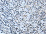 Immunohistochemistry of paraffin-embedded Human tonsil tissue using STARD4 Polyclonal Antibody at dilution of 1:50(×200)