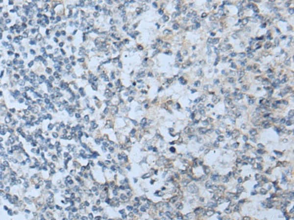 Immunohistochemistry of paraffin-embedded Human tonsil tissue using STARD4 Polyclonal Antibody at dilution of 1:50(×200)