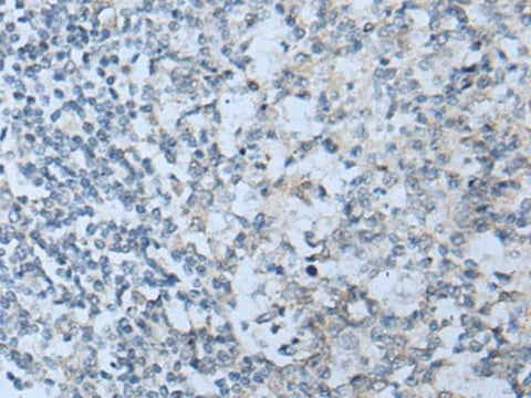 Immunohistochemistry of paraffin-embedded Human tonsil tissue using STARD4 Polyclonal Antibody at dilution of 1:50(×200)