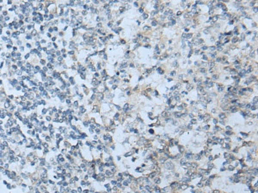 Immunohistochemistry of paraffin-embedded Human tonsil tissue using STARD4 Polyclonal Antibody at dilution of 1:50(×200)