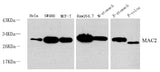 Western Blot analysis of various samples using Galectin 3 Polyclonal Antibody at dilution of 1:1000.