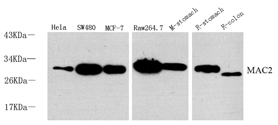 Western Blot analysis of various samples using Galectin 3 Polyclonal Antibody at dilution of 1:1000.