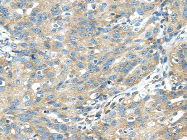 Anti-Human/Mouse TXNDC5 Antibody