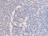 Immunohistochemistry of paraffin-embedded Human tonsil tissue using CCT5 Polyclonal Antibody at dilution of 1:60(×200)