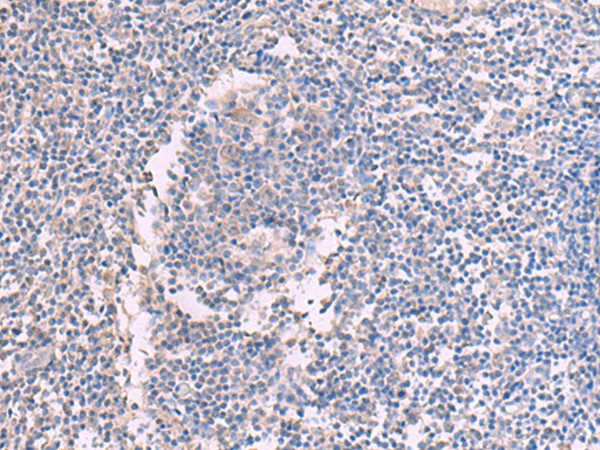 Immunohistochemistry of paraffin-embedded Human tonsil tissue using CCT5 Polyclonal Antibody at dilution of 1:60(×200)