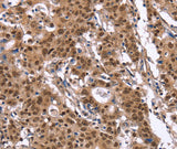 Anti-Human/Mouse ID4 Antibody - ABMIUM