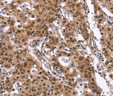 Anti-Human/Mouse ID4 Antibody - ABMIUM