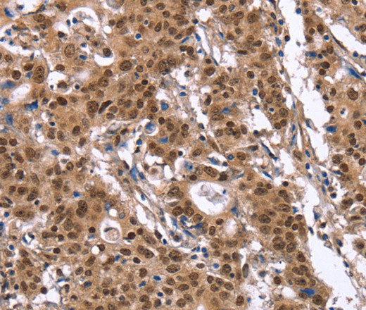 Anti-Human/Mouse ID4 Antibody - ABMIUM